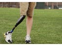Prosthetic limb